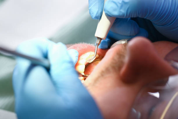 Best Emergency Dental Services for Seniors in Newport, SC